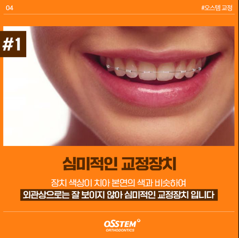 심미적인 오스템 교정장치 안내 이미지
